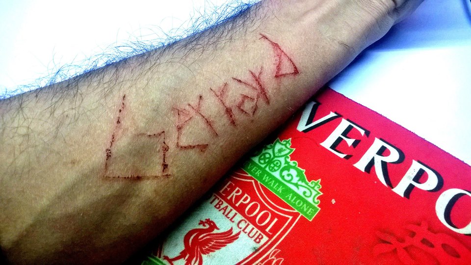 Gerrard Liverpool Cut Hand